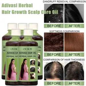 100ML Hair Growth Oil, India Adivasi Herbal Hair Care, Rosemary Repair, Hydrate & Moisturize Scalp, Reduce Dandruff, Rosemary Oil For Hair Growth, Scalp Stimulating Oil