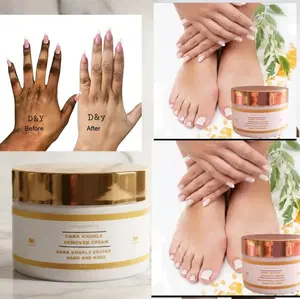 Dark Knuckles Remover Hand and Feet  Cream for Effective Treatment