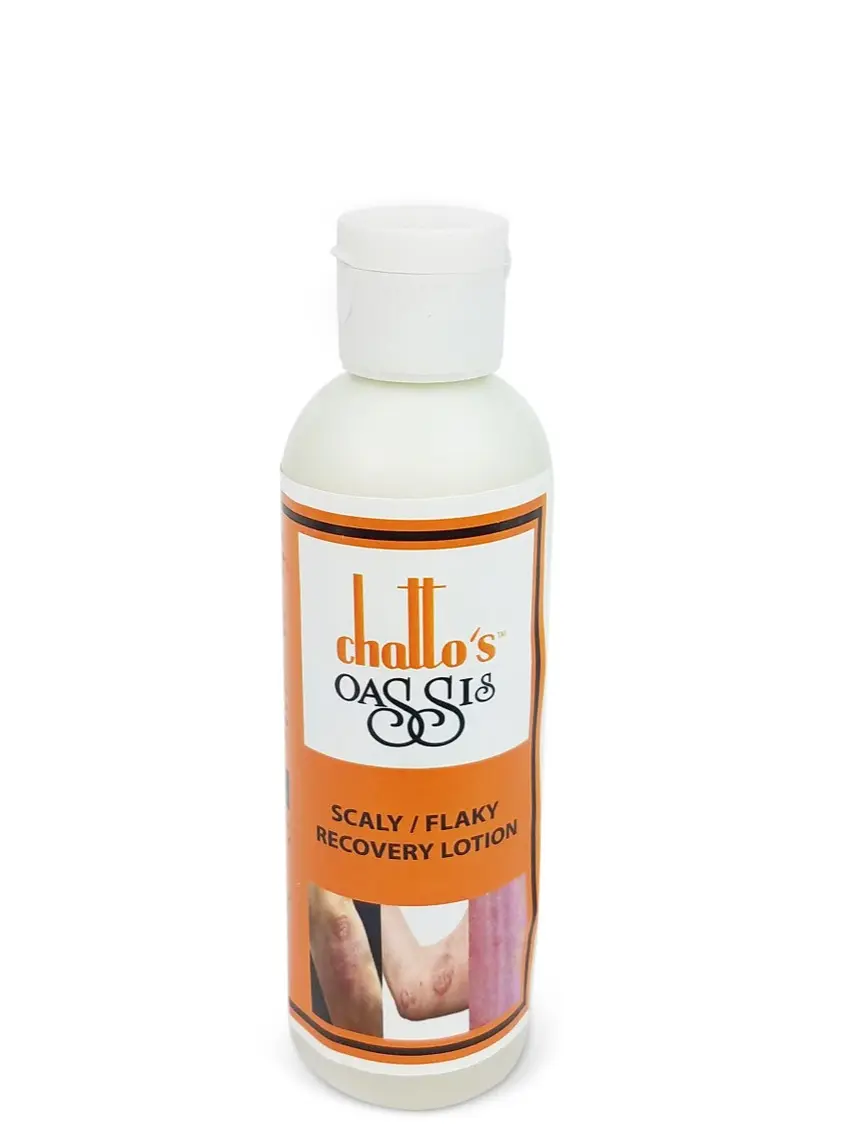 Skin Comfort & Moisture Support Lotion for Dry & Sensitive Skin – Children & Adults | Gentle Moisturizing, Hydrating & Soothing Lotion - Smooth Soft Skin Care - Daily Use