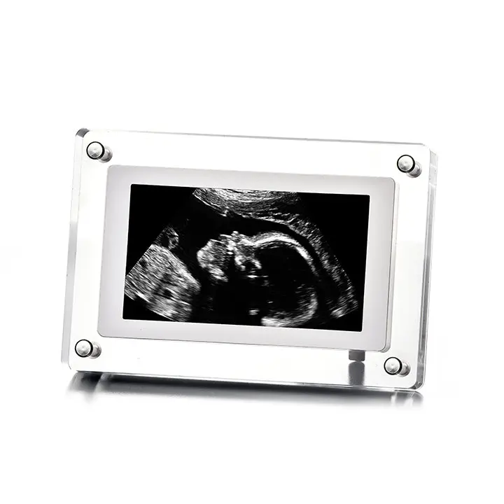 Digital Video Frames