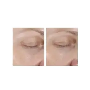 Alastin Restorative Eye Treatment is a must-have for anyone looking to rejuvenate their eye area. this Eye Cream treatment is packed with powerful ingredients. This  Cream is Smooth and contains Shea Butter