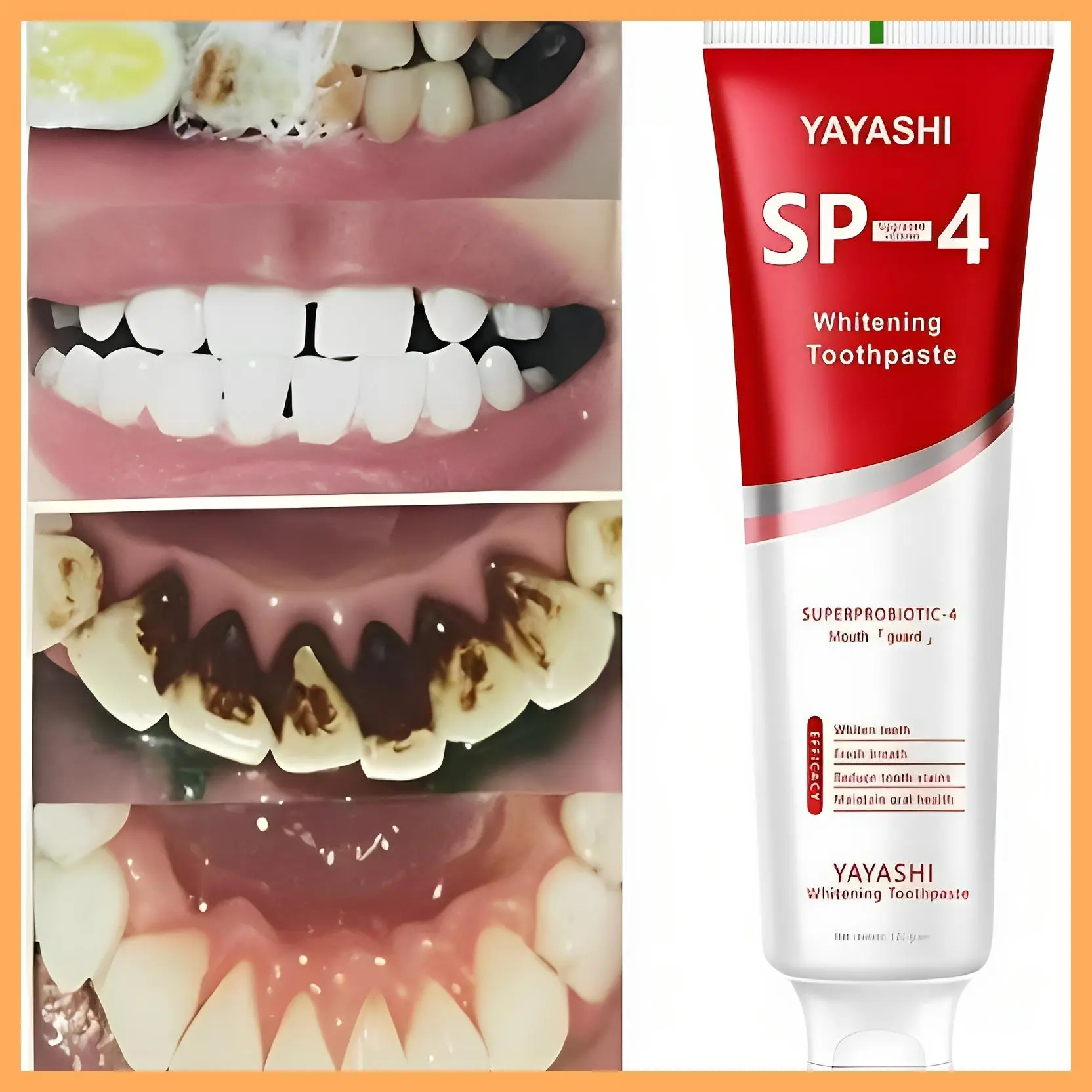 SP-4 Toothpaste-Advanced Oral Care with Probiotics - Long-lasting Fresh Breath and Enamel Protection - Oral Toothpaste