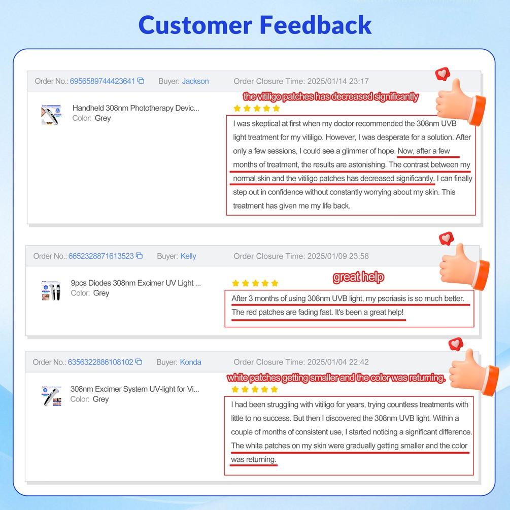 ZJZK 9 Diodes 308nm UVB Excimer Phototherapy Device, 55mW/cm² High Energy Density, Handheld Blue Light Skin Treatment, Targeted Therapy for Vitiligo, Psoriasis, Eczema, Atopic Dermatitis, Portable Home Use for Skin Disorders