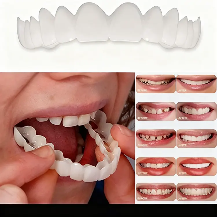 Removable Smile Veneers, Natural Looking Teeth Cover, Custom Fit Smile Accessory for Everyday Wear