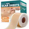 Professional Silicone Scar Reduction Roll (1 Roll - 1.5M/60"x1.6"), Reusable Non-Irritating Tape for Keloid, Acne Care, Suitable for All Ages