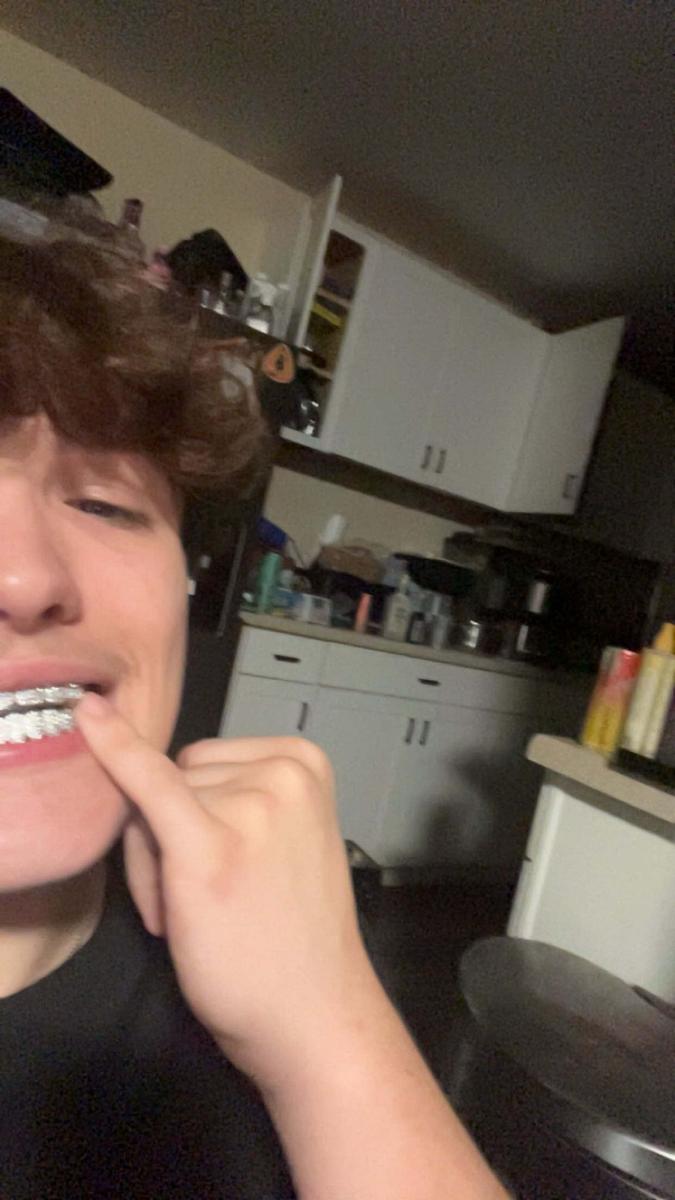 Item: Upper teeth + Lower teeth