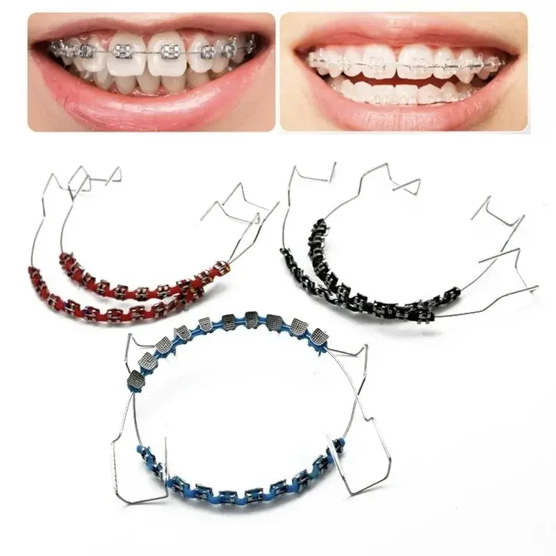 Oral Temporary Tooth Decoration Braces 1-Pair Pack - 1in Dental Accessories with Metal Wires, Brackets, Orthodontic Ligature Ties, Tooth Gems, Ball Hooks, Precise Groove Design, Low Friction for Oral Use (Smart & Wearable Devices, Wearable Accessories), T