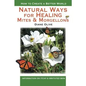 USED-Natural Ways for Healing Mites and Morgellons: Information on Itchy & Irritated Skin by Diane S. Olive (Paperback)