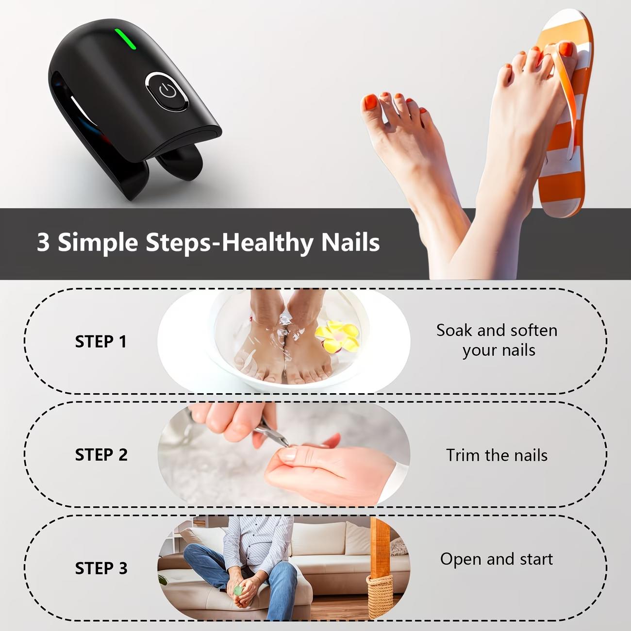 Nail Fungus Laser Treatment Device For Multiple Toenails - USB Rechargeable, Blue & Red Light Relax To Repair Discolored Or Damaged Nails At Home, Battery, Ergonomic Design For Comfortable Use