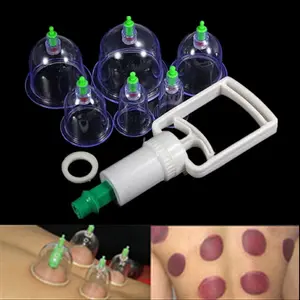 6 Cups Traditional Personal Care Chinese Medical Vacuum Body Cupping Set Massage Magnets Therapy Acupressure Healthy Suction Set Kit Equipment