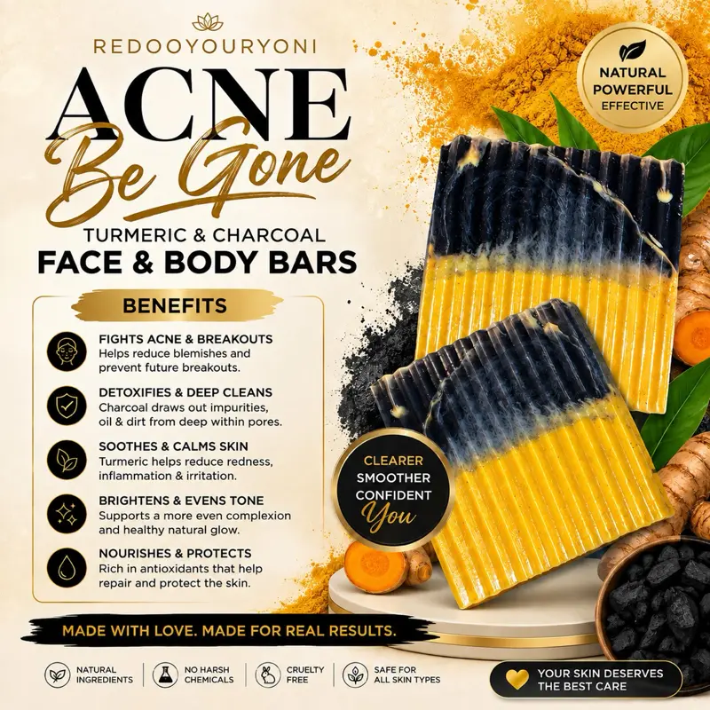 Redooyouryoni Acne Be Gone Soap Bar Turmeric & Charcoal with Lemon Eucalyptus Scent for Face & Body Deep Cleansing Refreshing Wash