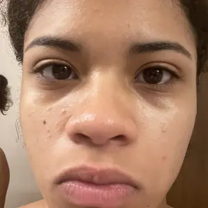 Product Review of Lion Pair Acne Cream Acne Treatment Pimples Removal Cream Pair Acne Creamy Foam Facial Wash Gentle Antibacterial from ️**️