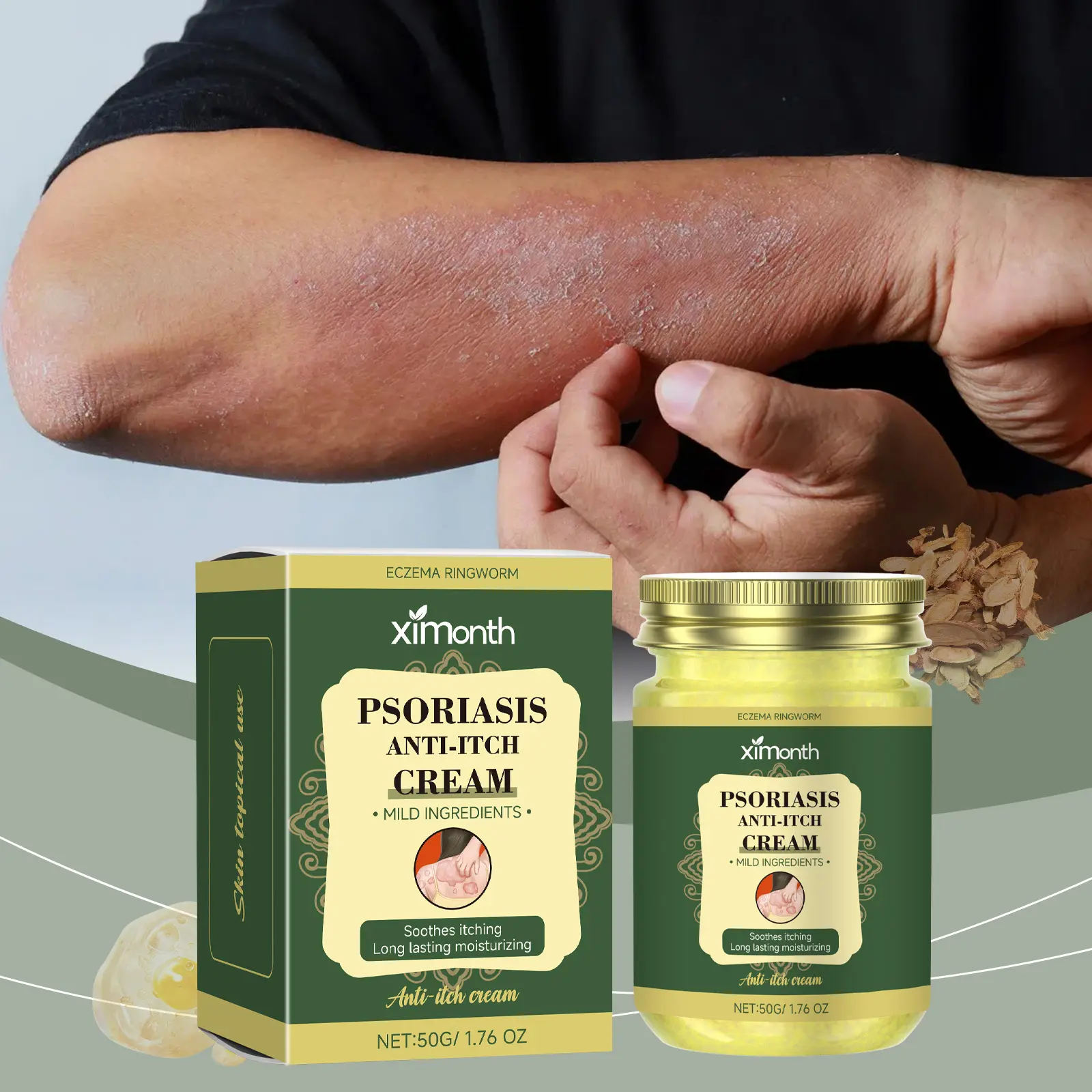 Ximonth Psoriasis Skin Care Cream – Deep Nourishment & Moisturizing Body Lotion for Gentle Daily Repair