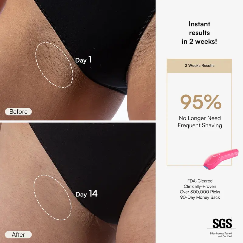 INIA HAUTE Pro Sapphire Ice-Cooling IPL Hair Removal Device – Painless, FDA Cleared, Full Body & Bikini Use, Long-Lasting Results for Women & Men, 2-Year Warranty – Stay Cool & Smooth, 2