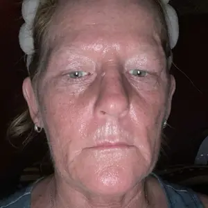 [NEW] [medicube] PDRN Pink Collagen Volume Multi Balm | All In One Volufiline, PDRN, NAD Stick for Youthful-Looking, Helping Look of Fine Lines, Firming Care, Anti-Aging Care | For Under-Eyes, Neck, Forehead, Smile Lines, Lip Care | Korean Skincare