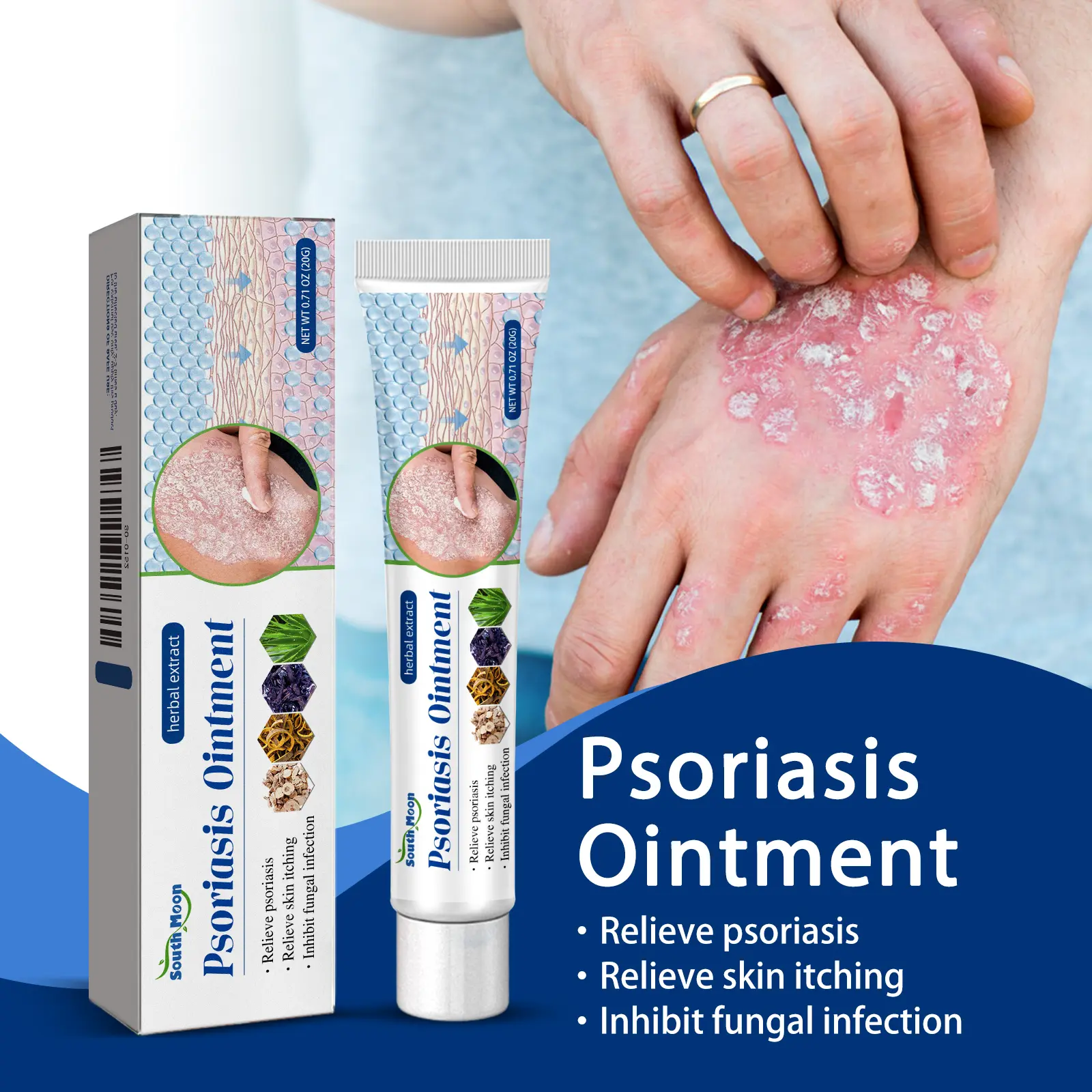Herbal Anti-Itch Cream for Fast Relief from Psoriasis, Eczema, and Dry Irritated Skin - An Intensive Skin Repair Wellness & Healthcare Solution, 20g, Therapy, Treatment