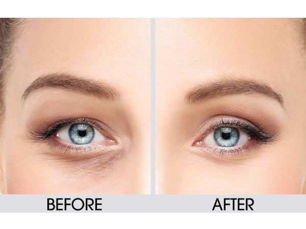 Dermactin Anti-Aging Upper Eyelid Cream 1 oz.