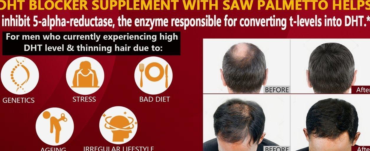 DHT Blocker for Men | Extra Strength Saw Palmetto & Biotin Hair Growth Supplement - Hair Growth Vitamins - Hair Regrowth - Natural Hair Loss Supplements for Men - Proprietary Herbal Blends,1 Pack
