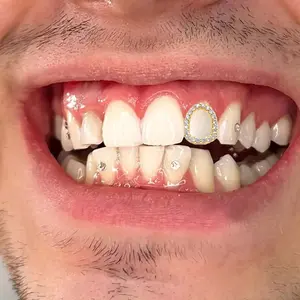 Single Zircon Star Grillz Tooth Cap – Hip Hop Style for Men & Women, Personalized Daily or Party Jewelry Gift