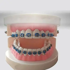 A pair of fashion metal tooth bracket decorations; a temporary colorful tooth decoration kit with hook for upper and lower teeth; fashionable tooth veneers made of metal; suitable for tooth models and teaching materials.