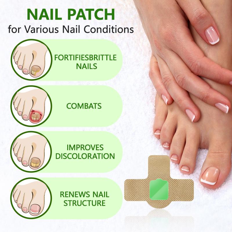 Lansiyi Fungal Nail Patches, 21pcs/box Nail Health CarePatches, Nail Fungus Care Patches with 5 Herbs for Solving Fungal Nails and Other Nail Problems, NailSupplies, Daily Care Nails Kit Set, Nail Tech Supplies,Self Care Tools Matte Japanese