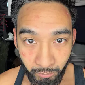 FORGE SKIN Wrinkle Defense & Natural Anti-Aging Beef Tallow Moisturizer for Men - Face Balm Skincare Cream for Dry Rough Skin Tallow-Based Mens Face Lotion for Hydration Firmness Wrinkle Repair & Glow Honey Jojoba Hydrating Smooth Skin Nourishing Moisture