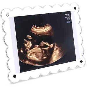 Clear Acrylic Scalloped Baby Ultrasound Picture Frame - Sonogram Frame for Refrigerator, Display for Pregnancy Announcement, Gender Reveal & Expecting Parents Gifts(No Stand)