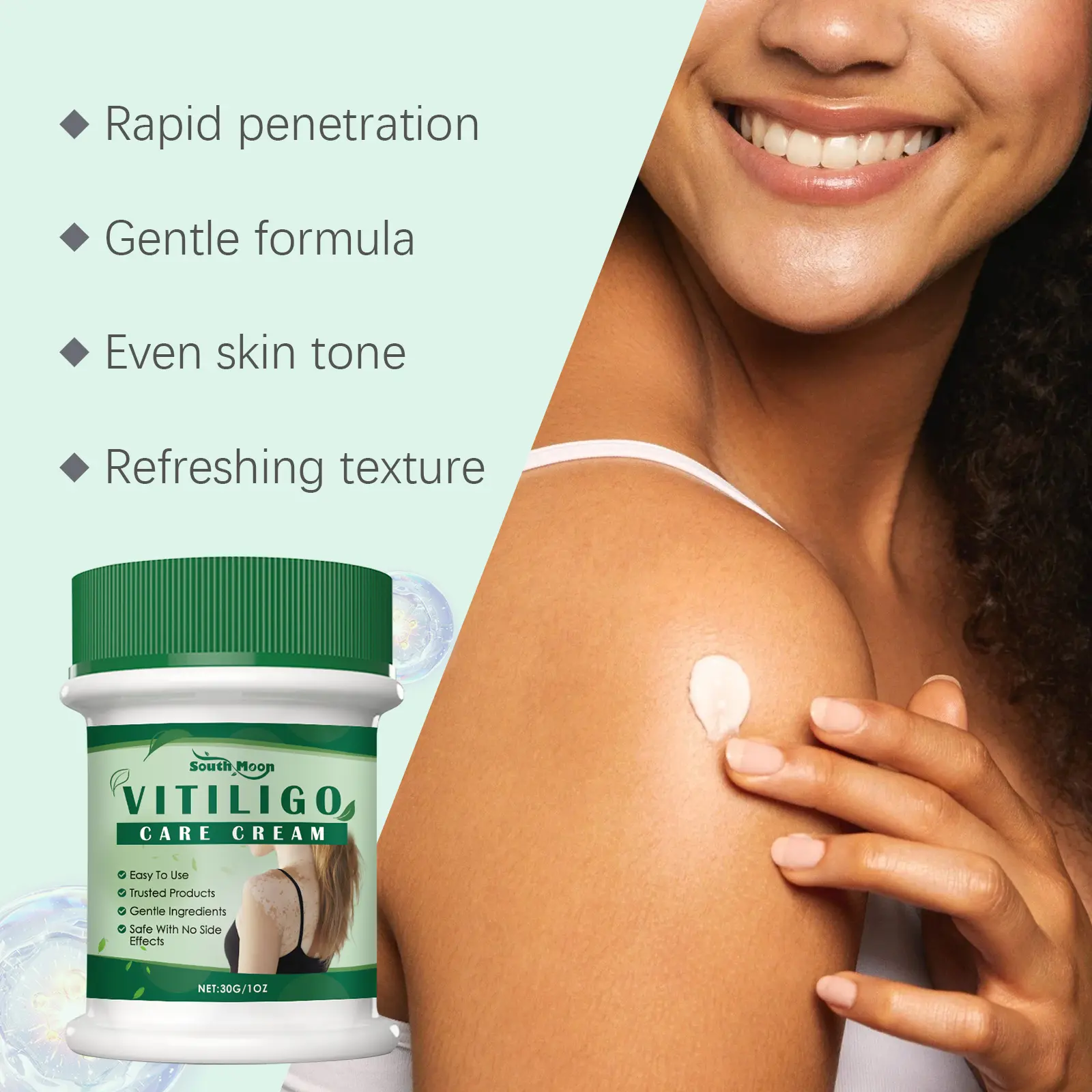South Moon Vitiligo Care Cream - Mint Leaves & Aloe Vera Extract  Moisturizing Body Skin Repair Cream for Even Skin Tone & Long-Lasting  Moisture - TikTok Shop