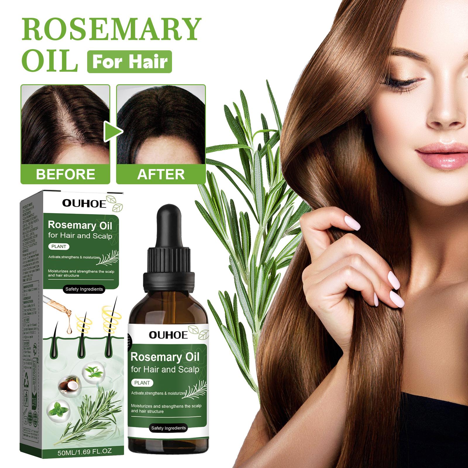 Rosemary Hair Oil，It clears away excess oil, dirt and dead skin cells on the scalp, nourishes the scalp and helps minimize hair shedding. It boosts scalp circulation, nourishes hair roots and replenishes nutrients essential for healthy hair growth.