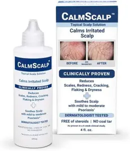 Scalp Solution | Calms Irritated, Itchy Scalp | Dry Scalp Treatment | Reduces Scales, Flakes & Redness | Clinically Proven | Start Seeing Results in 1 week | 4 oz