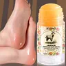 This lanolin hand and foot dry cracking stick, Foot Balm, Foot Care Products, is rich in lanolin, moisturizing and repairing dry and cracked skin, mild texture, hands and feet after use, bidding farewell to dryness and cracking