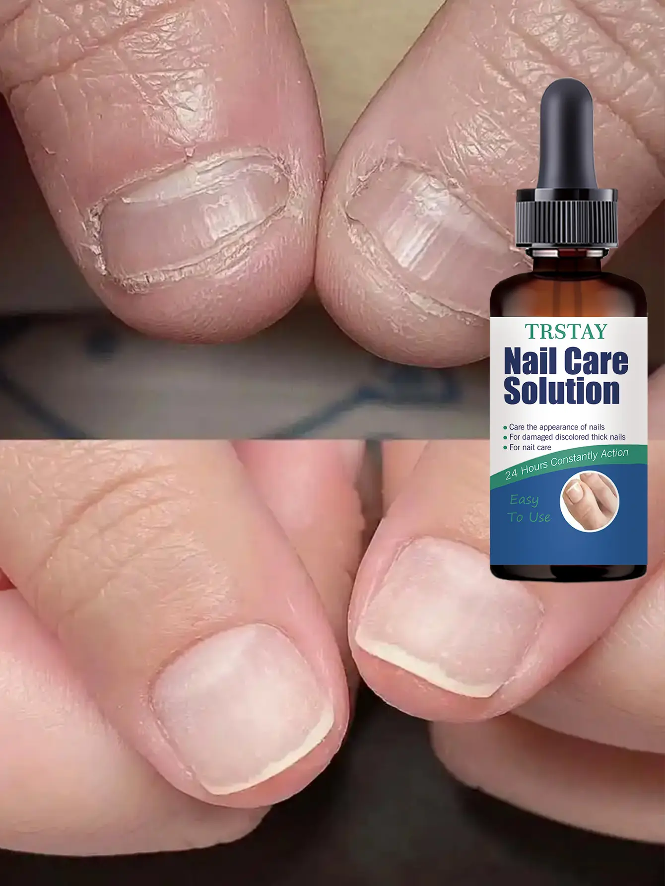 Nail Care Serum - Manicure Essential for Dry Cuticles, Daily Hydrating Moisture Boost to Achieve Soft, Smooth Nails