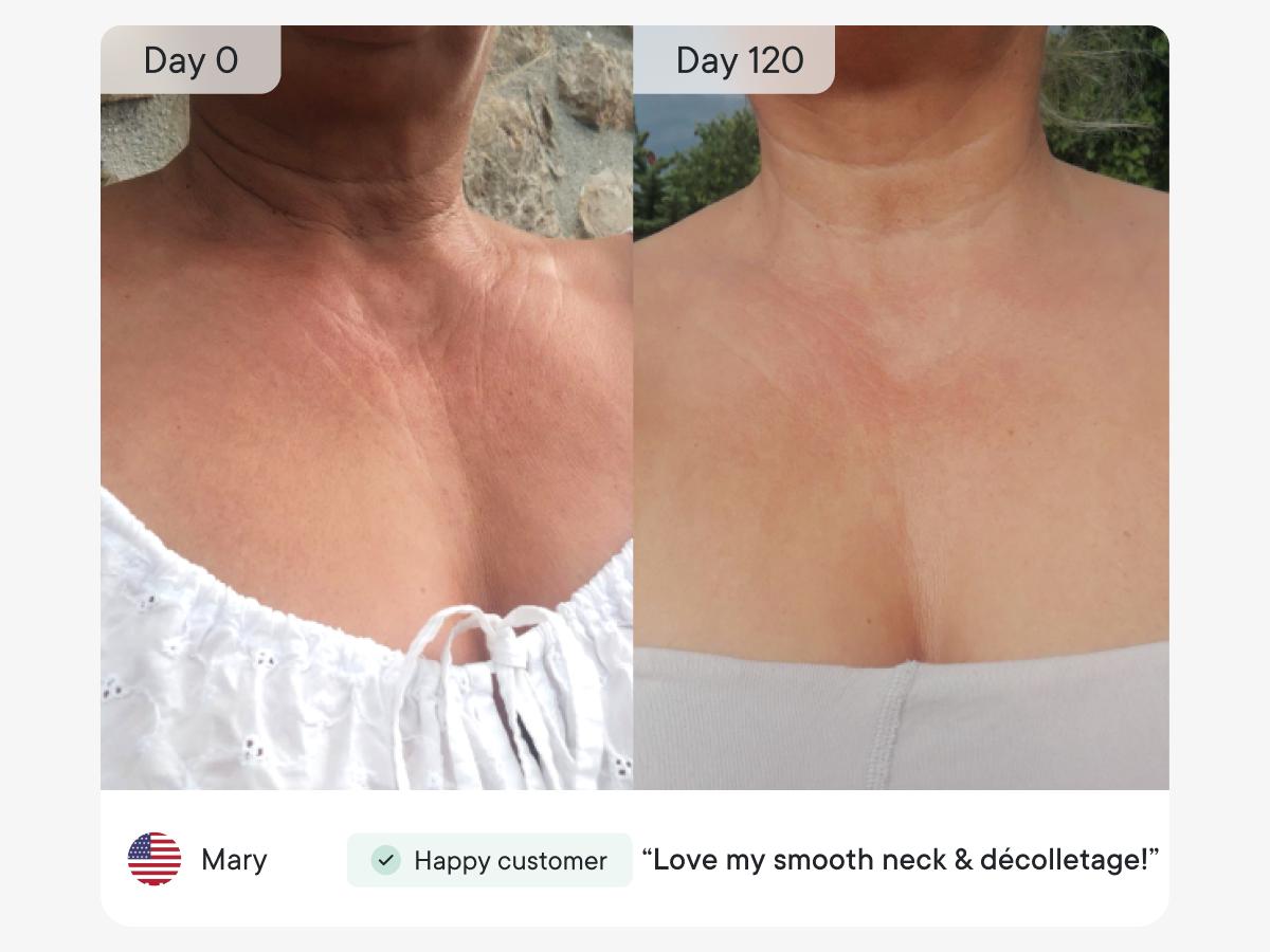 Qure Neck & Décolletage & Chest LED System, Red Light Therapy with 2 Wavelengths of Light, Red 633nm and Near-Infrared 830nmQure Neck & Décolletage & Chest LED System, Red Light Therapy with 2 Wavelengths of Light, Red 633nm and Near-Infrared 830nm