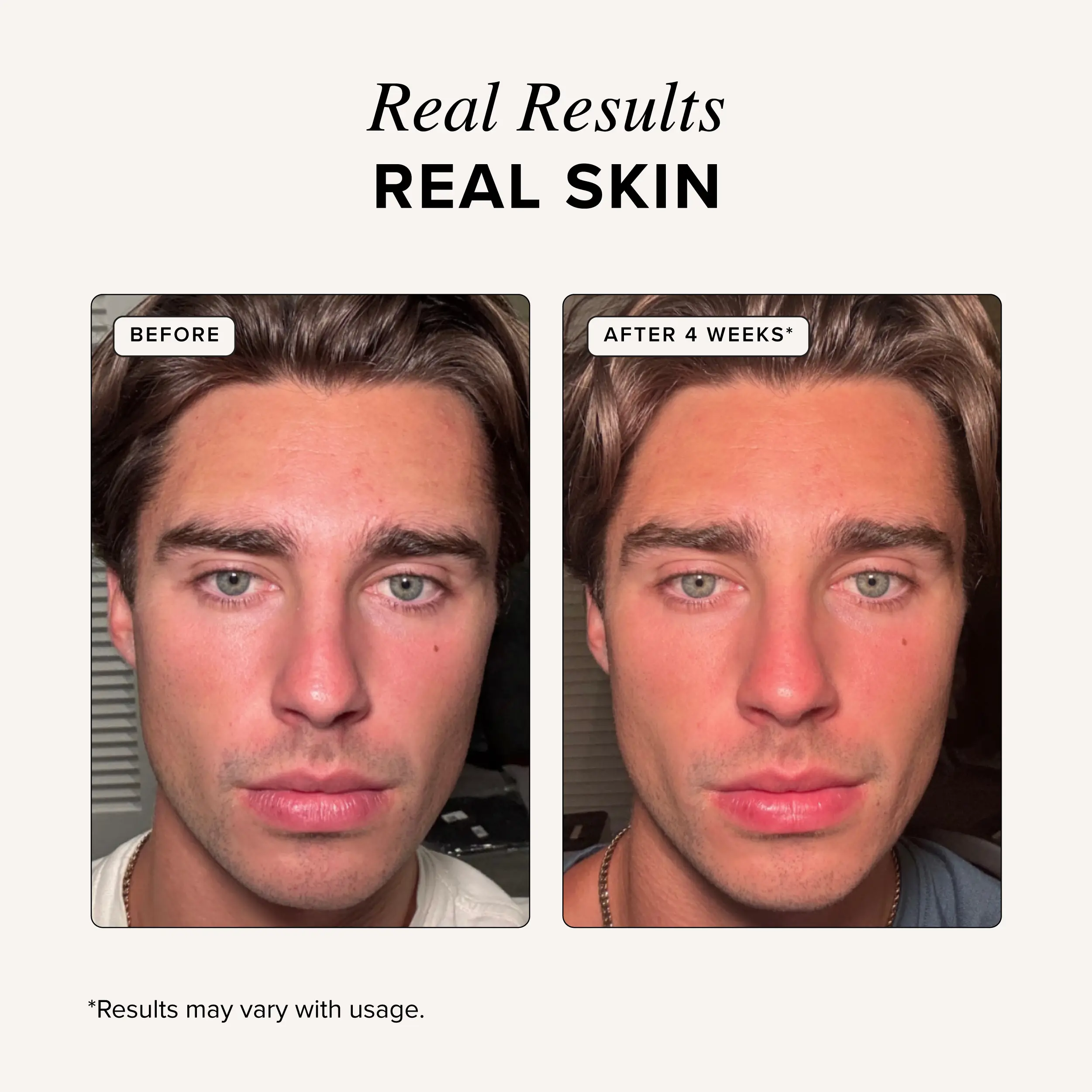 GHK Cu Peptide Serum Copper Peptide Serum for Tightening, Collagen Boosting & Hydrating Topical GHK-Cu with Hyaluronic Acid - TikTok Shop GHK Cu Peptide Serum Copper Peptide Serum for Tightening, Collagen Boosting & Hydrating Topical GHK-Cu with Hyaluronic Acid - TikTok Shop