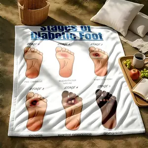 1 piece Diabetic foot development staging and lesion characteristics_5639 themed flannel blanket - All-season comfortable flannel blanket, modern style, suitable for sofas and beds, digitally printed pattern, super soft and warm, 100% polyester