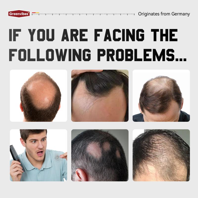 Greenvibes 1 Hair Care Essence  Containing Ingredients such as Butylene Glycol, Glycerin, and Polyaminoglycoside Condensates Enhance Strength and Vitality