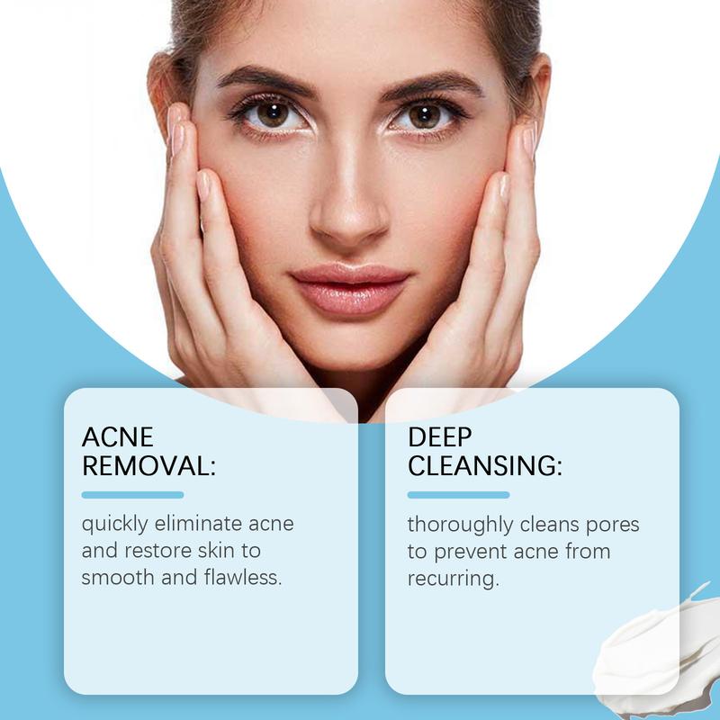 SOUTH MOON Skin Cream Helps Remove And Improve Skin Blemishes Gentle And Comfortable Controls Oil Secretion