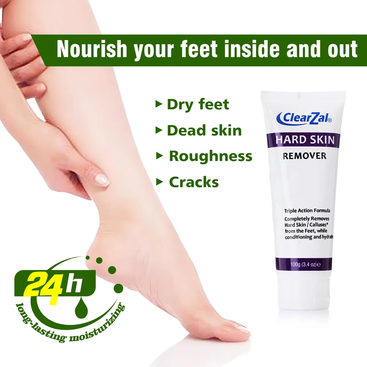 Clearzal Dry  Cracked Feet Repair Ultra-Hydrating Hand and Foot Cream Hard Skin Moisturizer, 3.5 oz. Contains Urea, Salicylic Acid, for Dry, Chapped, Cracked Feet, Dead Skin Remover, For Thick, Cracked, Rough Skin , dead skin and dry skin cream repair[YW]