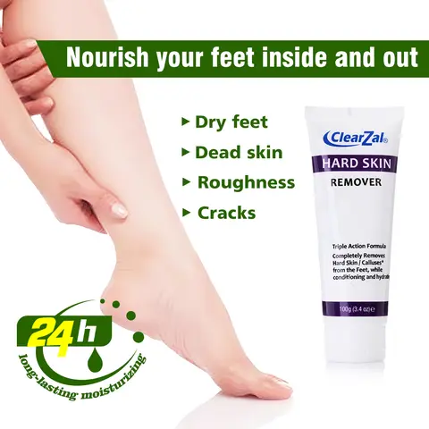 Clearzal Dry  Cracked Feet Repair Ultra-Hydrating Hand and Foot Cream Hard Skin Moisturizer, 3.5 oz. Contains Urea, Salicylic Acid, for Dry, Chapped, Cracked Feet, Dead Skin Remover, For Thick, Cracked, Rough Skin , dead skin and dry skin cream repair[YW]