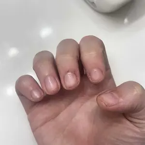 Product Review of Radiant Cosmetics Nail Growth Oil - 100% Organic, Moisturizing, Growth, Strengthening, and Brightening Formula with Vitamins and Fatty Acids for Overall Nail Health from **