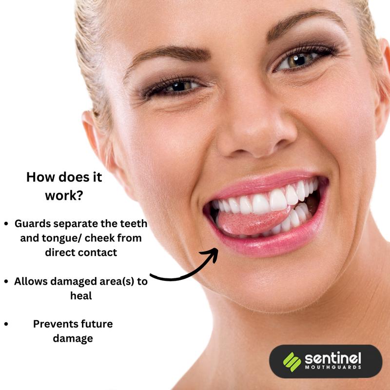 Sentinel Mouthguards Tongue & Cheek Biting Relief Mouth Guards