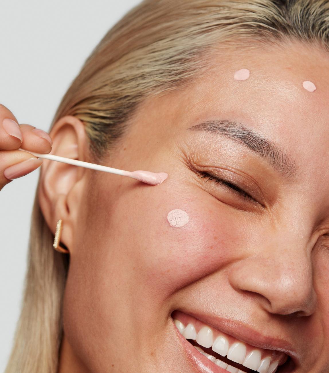 Kate Somerville EradiKate® 10% Sulfur Acne Treatment - Fast Acting Spot Solution for Clinical Acne Control & Redness Relief - 1 Fl Oz Kate Somerville EradiKate® 10% Sulfur Acne Treatment - Fast Acting Spot Solution for Clinical Acne Control & Redness Relief - 1 Fl Oz