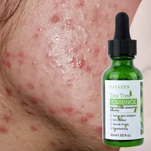 30ml Green Tea Essence Liquid Unclogs pores, boosts metabolism, reduces acne and red marks caused by clogged breakouts and skin irritation.