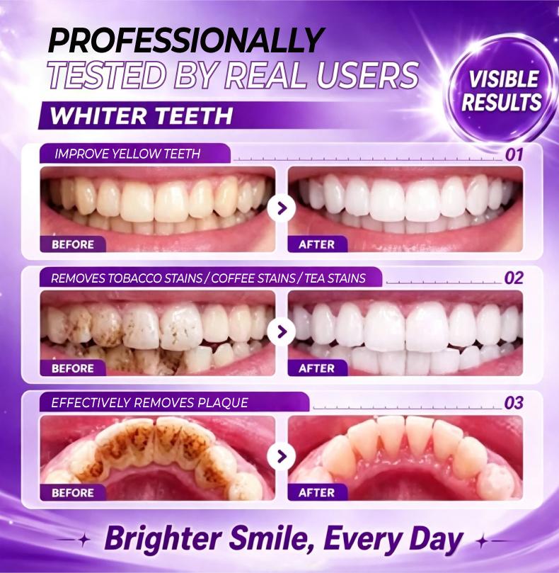 YOOMU 1 Purple Bright White Toothpaste | Color Repair & Yellow Stain Removal + Long-Lasting Freshness