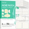TKTK Gentle Hydrocolloid Pimple Patches - Anti-Acne Adhesive Facial Patch Treatments, 6 Sizes, 4 Shapes, 356 Count Peelable Stickers for Sensitive Skin, Skin Repair, Self Care Products, Acne Clearing Products (Cheeks, Forehead Use)