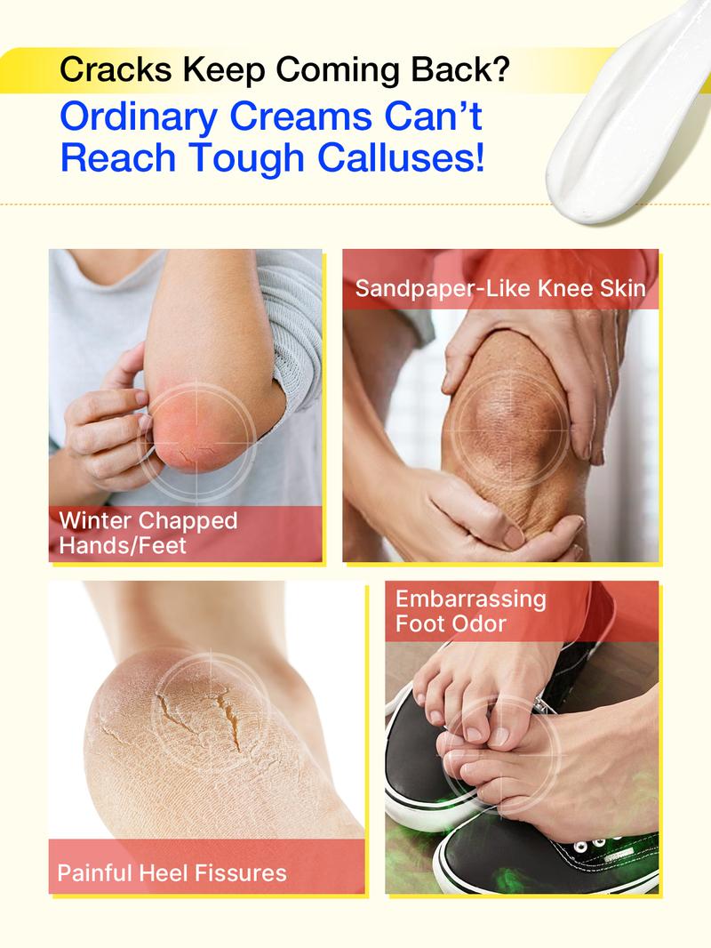 Aavini Intense Foot Cream - Repairs Cracked Skin, Antibacterial and Deodorizing, Removes and Softens Calluses, For All Skin Types, Moisturizing Foot Lotion Aavini Intense Foot Cream - Repairs Cracked Skin, Antibacterial and Deodorizing, Removes and Softens Calluses, For All Skin Types, Moisturizing Foot Lotion