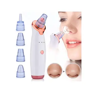 2026 Upgrade 3-Speed Adjustable Electric Blackhead Remover, Battery Powered Facial Pore Cleaner, Rechargeable Whitehead Suction Device - 5 Suction Heads, Unisex Daily Light Cleaning Tool, Great Gift for Valentine's Day, TikTokMadeMeBuyIt