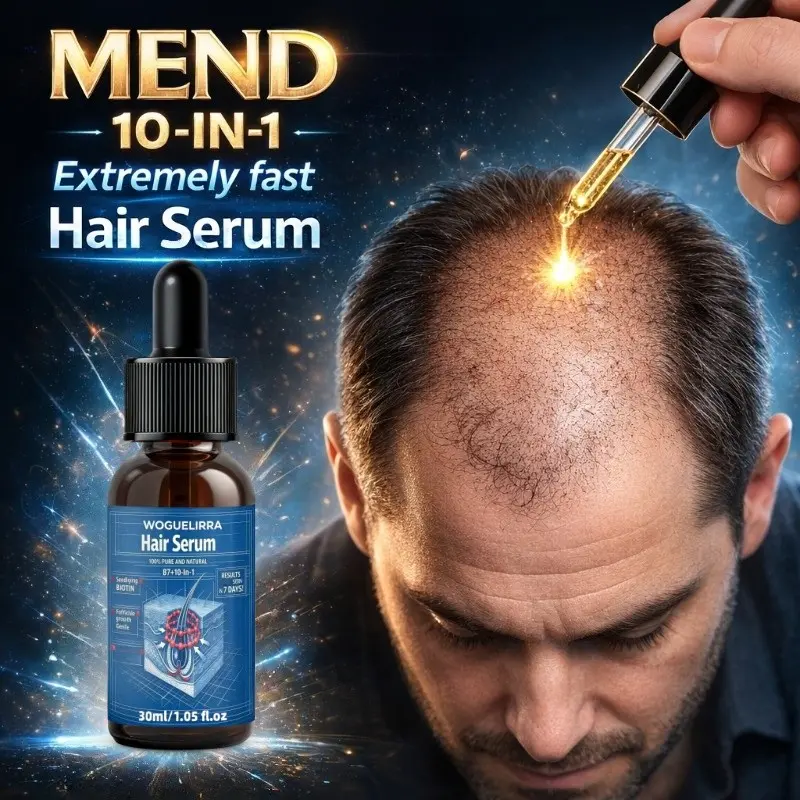 Rosemary Scalp Oil, Herbal Formula for Healthy Hair Growth, Daily Scalp Care Solution, Relieves Dry Itchy Scalp, Natural Ingredients, Hair Growth Oils, Hair Product