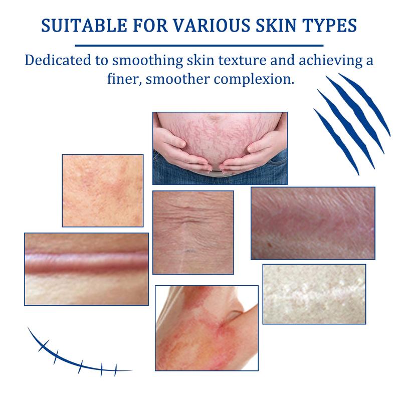 2 Scar Removal Cream 30g Silicone Gel for Surgical & Keloid Scars All-Natural Ingredients Gentle Formula for Sensitive Skin Lightweight Breathable Universal Compatibility