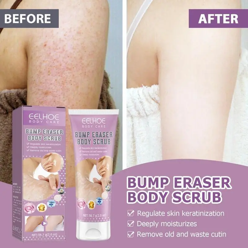 Keratosis Pilaris (KP) Body Scrub - 10% Glycolic Acid & Pumice Physical Exfoliating Cleanser, Sensitive Skin Blend, Gentle Silky Body Care to Smooth Rough Bumpy Skin & Restore Glow (Strawberry), No